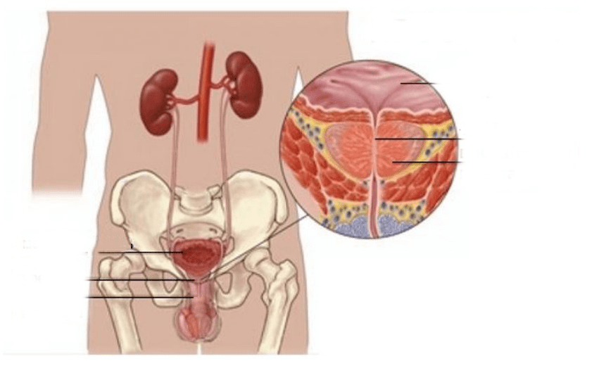 erkeklerde prostatit