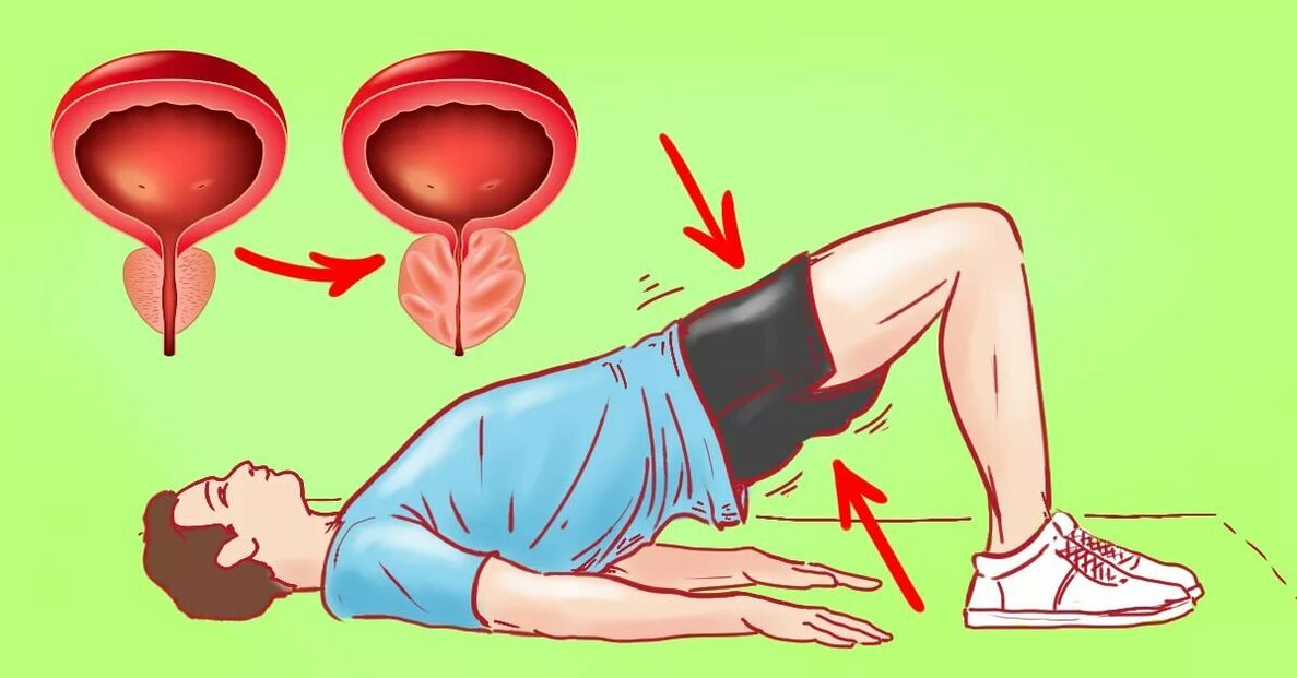 Prostatit için egzersizler